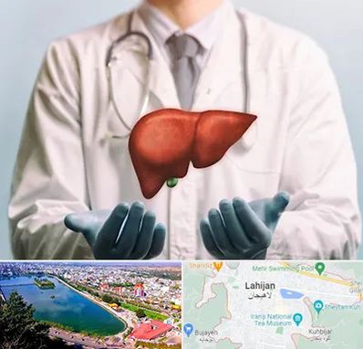 جراح سرطان کبد در لاهیجان