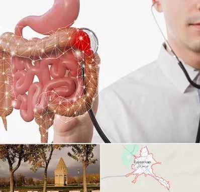 دکتر سرطان روده بزرگ در تویسرکان