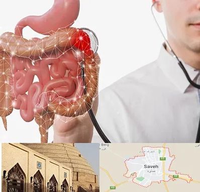 دکتر سرطان روده بزرگ در ساوه