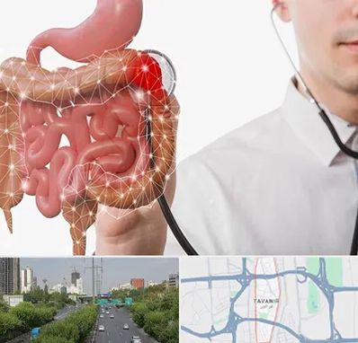 دکتر سرطان روده بزرگ در توانیر