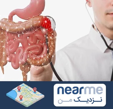 دکتر سرطان روده بزرگ در نزدیک من