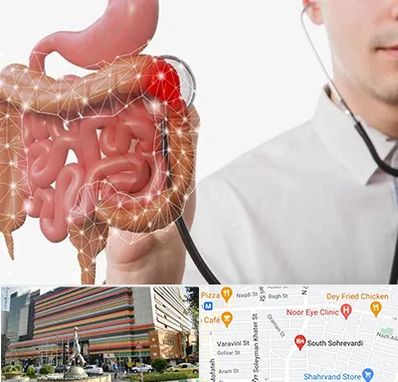 دکتر سرطان روده بزرگ در سهروردی 