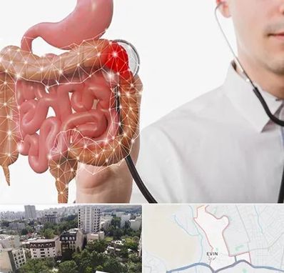 دکتر سرطان روده بزرگ در اوین