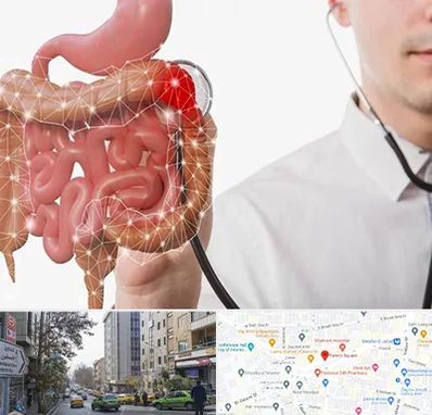 دکتر سرطان روده بزرگ در فاطمی 