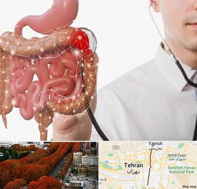 دکتر سرطان روده بزرگ در ولیعصر 