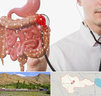 دکتر سرطان روده بزرگ در خاش