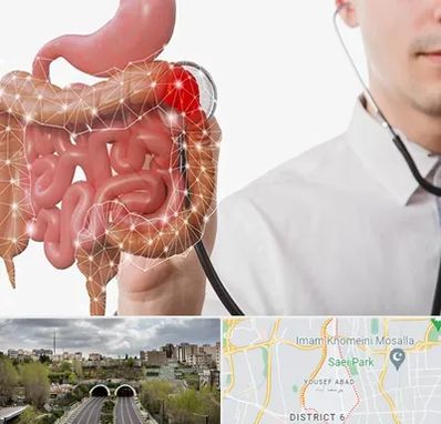 دکتر سرطان روده بزرگ در یوسف آباد 