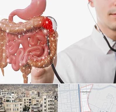 دکتر سرطان روده بزرگ در اسکندری