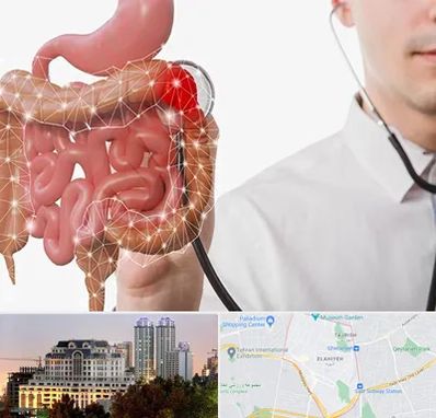 دکتر سرطان روده بزرگ در فرشته 