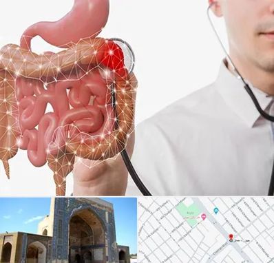 دکتر سرطان روده بزرگ در مصلی مشهد