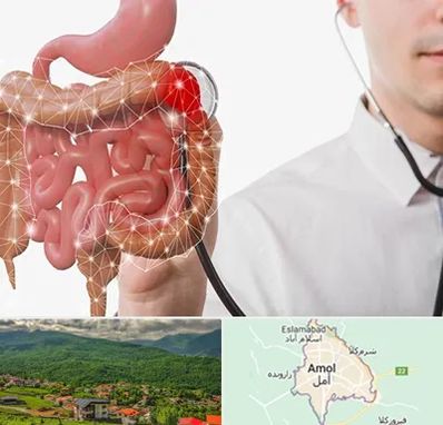 دکتر سرطان روده بزرگ در آمل