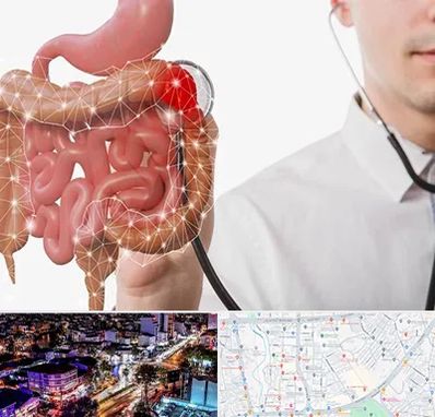 دکتر سرطان روده بزرگ در منظریه رشت 