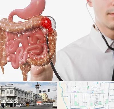 دکتر سرطان روده بزرگ در 17شهریور