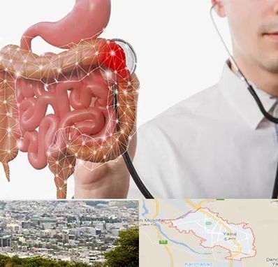 دکتر سرطان روده بزرگ در یاسوج