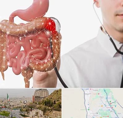 دکتر سرطان روده بزرگ در فرهنگ شهر شیراز 