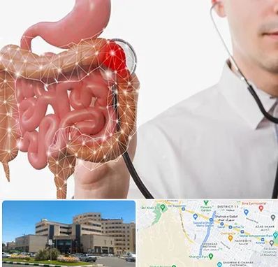 دکتر سرطان روده بزرگ در صیاد شیرازی مشهد 