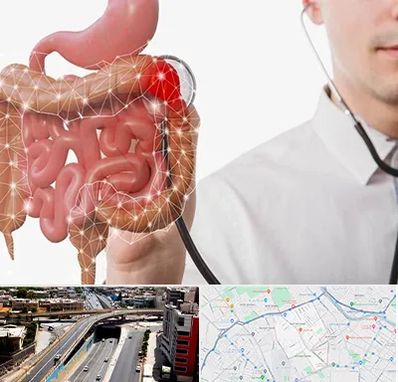 دکتر سرطان روده بزرگ در ستارخان شیراز 