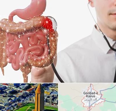 دکتر سرطان روده بزرگ در گنبد کاووس