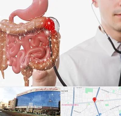 دکتر سرطان روده بزرگ در نصف راه تبریز