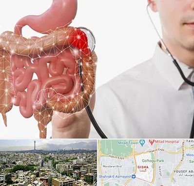 دکتر سرطان روده بزرگ در گیشا 