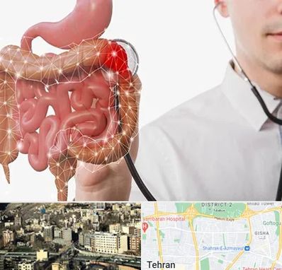 دکتر سرطان روده بزرگ در مرزداران 