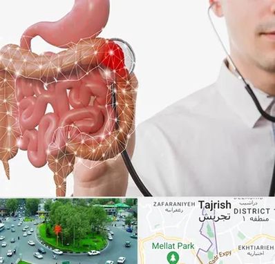 دکتر سرطان روده بزرگ در تجریش 