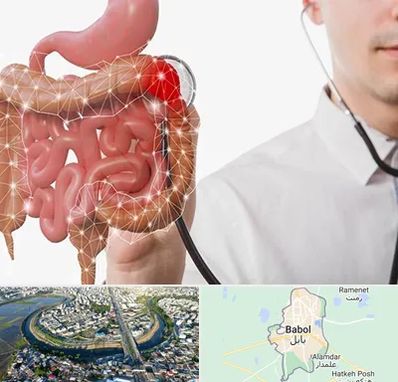 دکتر سرطان روده بزرگ در بابل