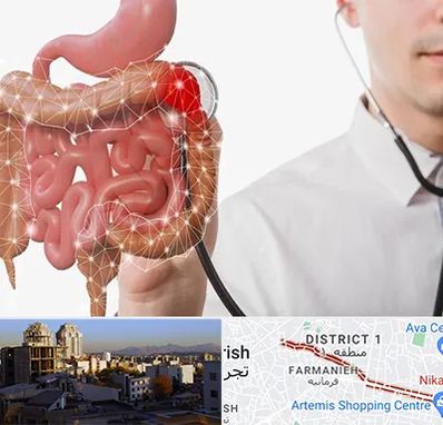 دکتر سرطان روده بزرگ در فرمانیه 
