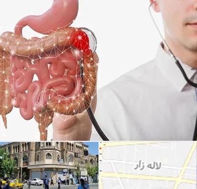 دکتر سرطان روده بزرگ در لاله زار