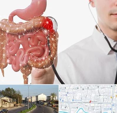 دکتر سرطان روده بزرگ در ضیابری رشت 
