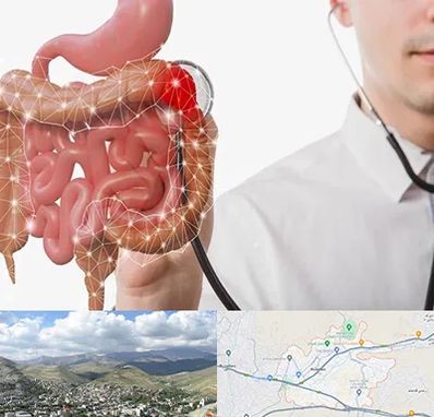 دکتر سرطان روده بزرگ در رودهن