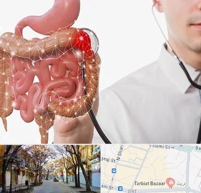 دکتر سرطان روده بزرگ در تربیت تبریز