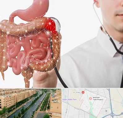 دکتر سرطان روده بزرگ در فاز سه اندیشه