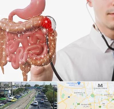 دکتر سرطان روده بزرگ در جنوب تهران 