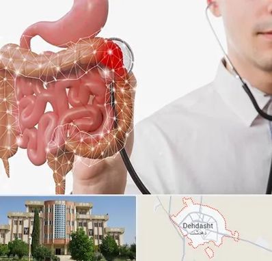 دکتر سرطان روده بزرگ در دهدشت
