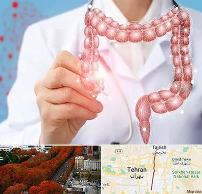 جراح سرطان روده بزرگ در ولیعصر 
