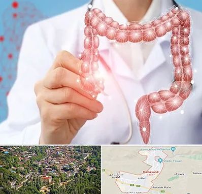 جراح سرطان روده بزرگ در دماوند