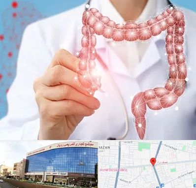 جراح سرطان روده بزرگ در نصف راه تبریز