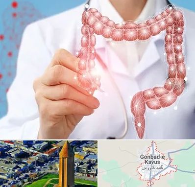 جراح سرطان روده بزرگ در گنبد کاووس