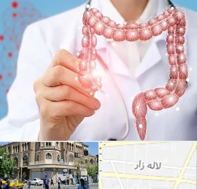 جراح سرطان روده بزرگ در لاله زار
