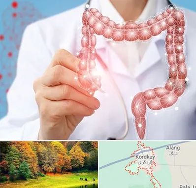 جراح سرطان روده بزرگ در کردکوی