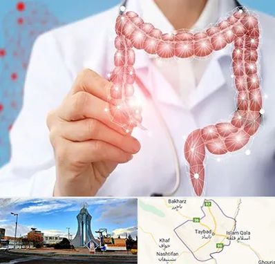 جراح سرطان روده بزرگ در تایباد