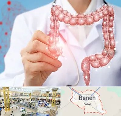 جراح سرطان روده بزرگ در بانه
