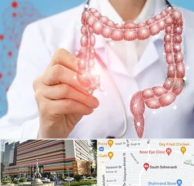 جراح سرطان روده بزرگ در سهروردی 