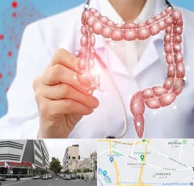 جراح سرطان روده بزرگ در بلوار فردوس 