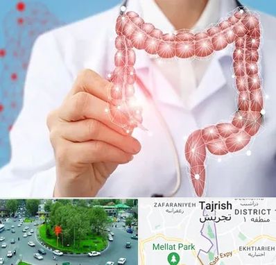 جراح سرطان روده بزرگ در تجریش 
