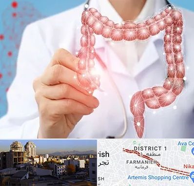 جراح سرطان روده بزرگ در فرمانیه 