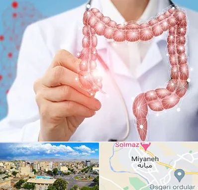 جراح سرطان روده بزرگ در میانه