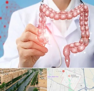 جراح سرطان روده بزرگ در فاز سه اندیشه