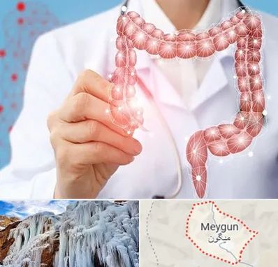 جراح سرطان روده بزرگ در میگون